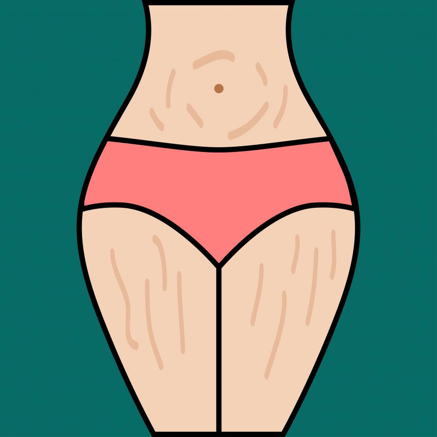 Няколко съвета за справяне със стриите