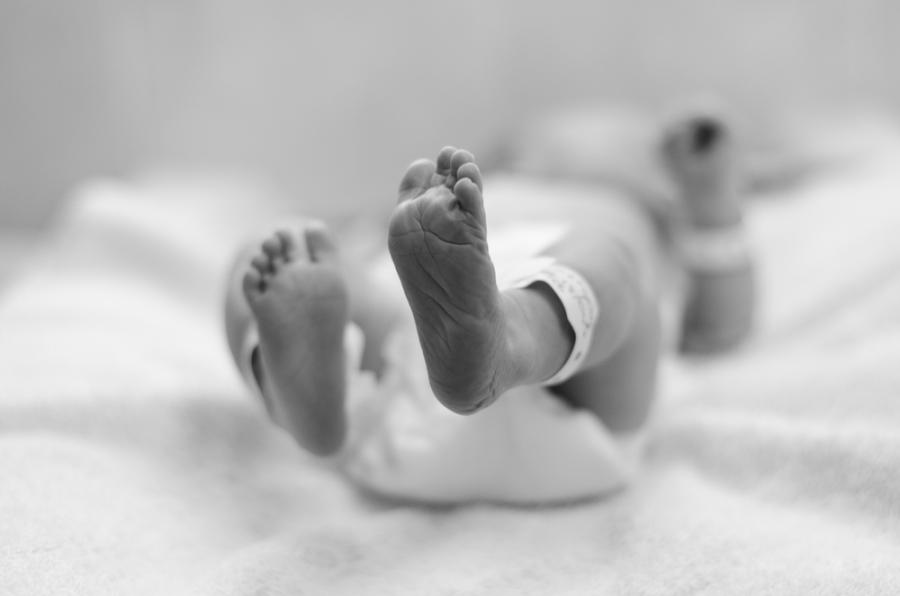 В Португалия се роди бебе без лице