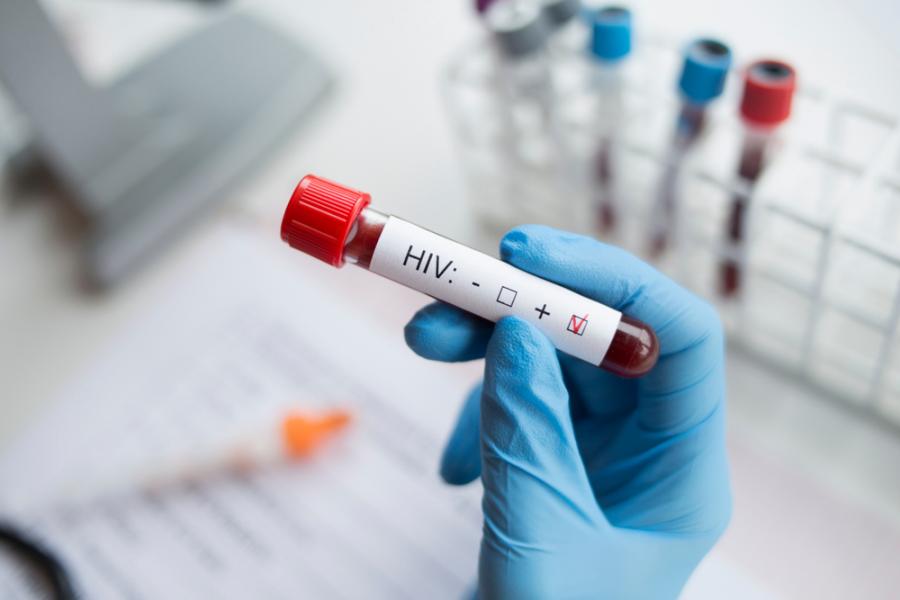 Учени твърдят, че са открили лекарство срещу ХИВ