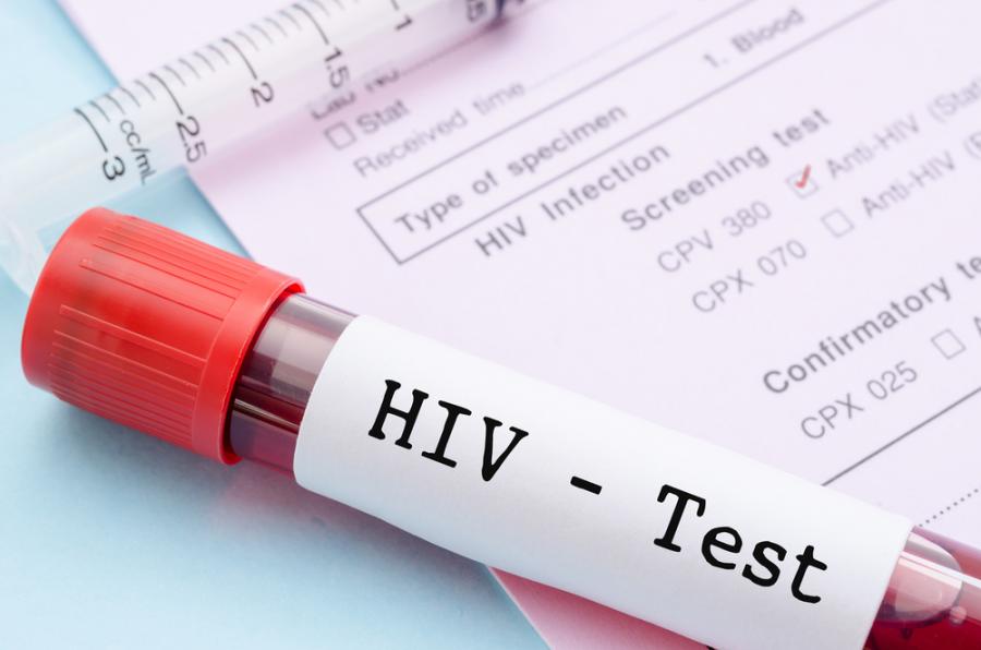 Учени са на крачка от откриването на лечение на ХИВ