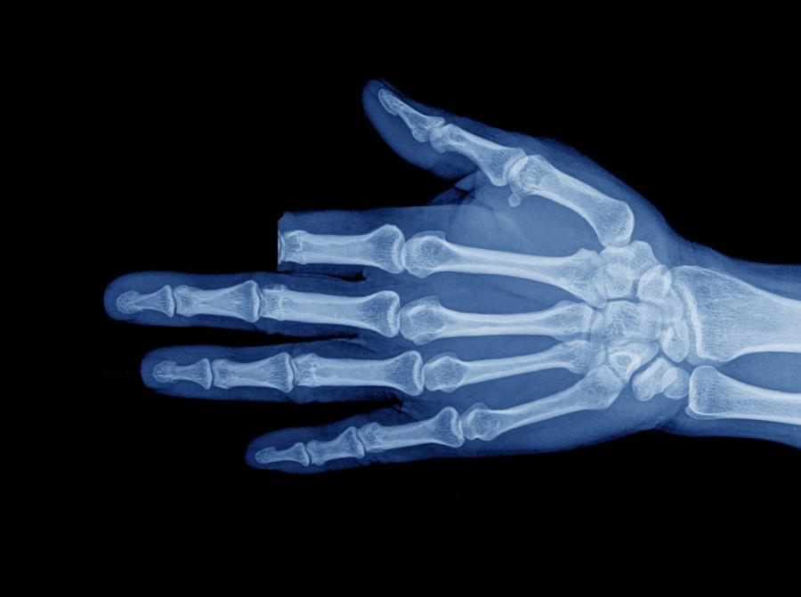 След ухапване от змия мъж отрязва пръста си, за да „спаси живота си“. Оказва се, че не е било нужно