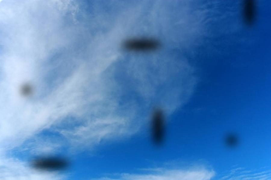 Какви са тези странни неща, които виждате да плуват в очите ви?