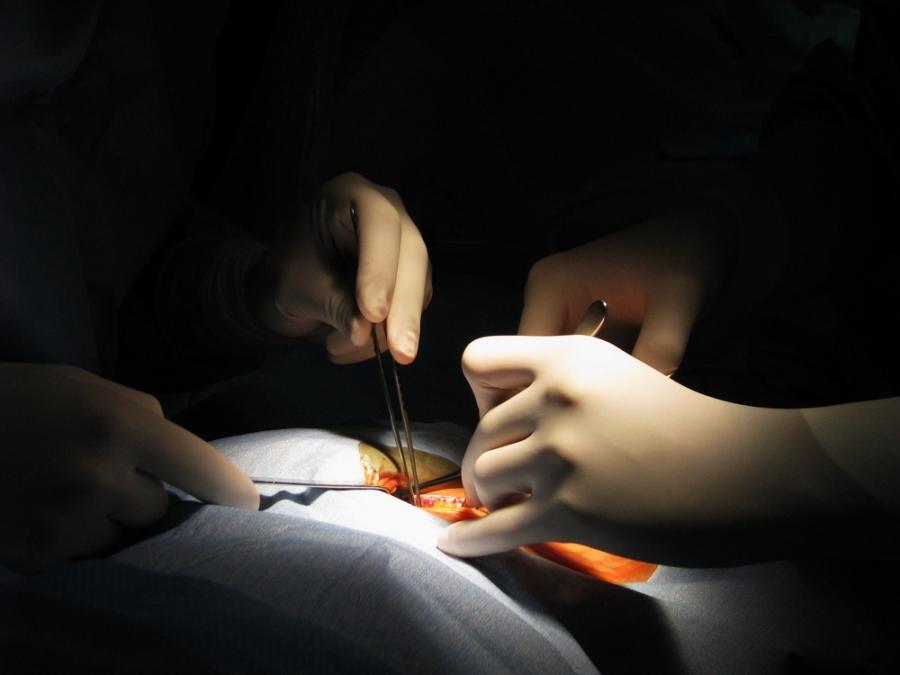 Лекари от Тексас успешно присадиха матка от жив донор за първи път