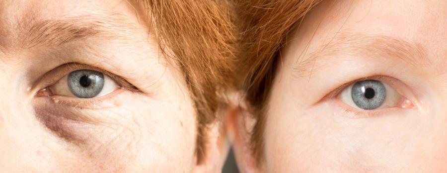 Премахването на “пенсионирани” клетки от тялото може да спре остаряването