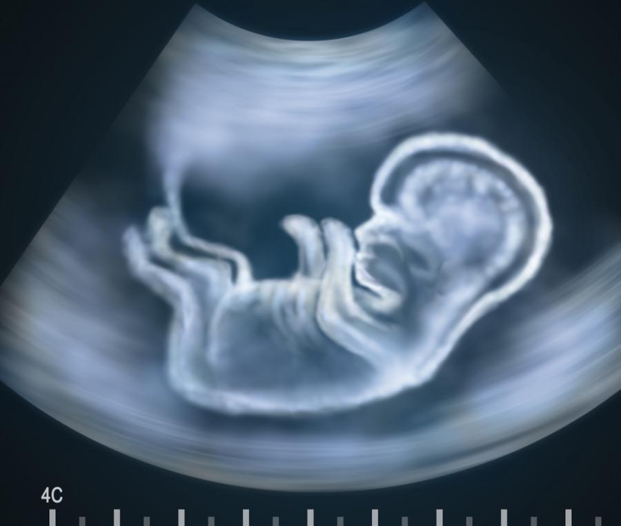Нероденото бебе „знае“ дали е желано. Чува, усеща, дори може да учи