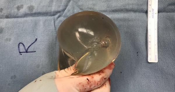 Учени съобщиха за първия документиран случай в медицинската литература при