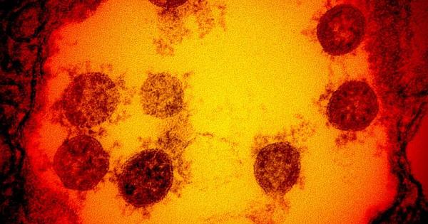 Вариантът Делта на COVID 19 известен първоначално като индийския вариант е