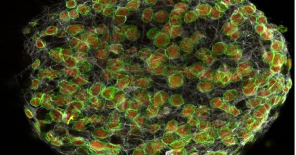 Процесът на стареене често е свързан с появата на неврологични