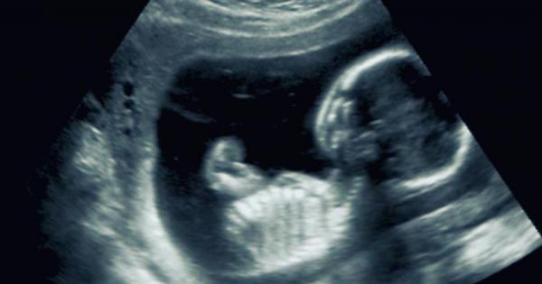 През 2016 а лекарите стават свидетели на изключително рядък феномен когато