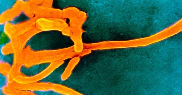 Една група бактерии фузобактерии може да са свързани с