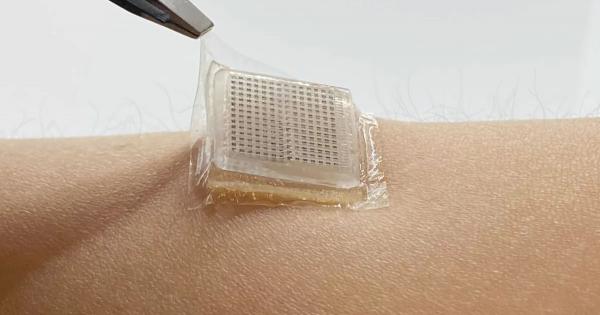 Учени от Масачузетският технологичен институт са разработили лепенка с размерите