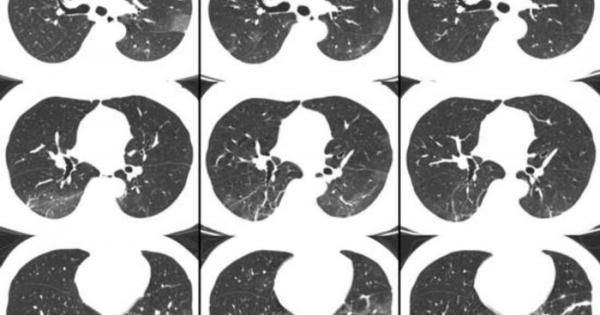 Това което стана известно като Covid 19 или новия коронавирус започна