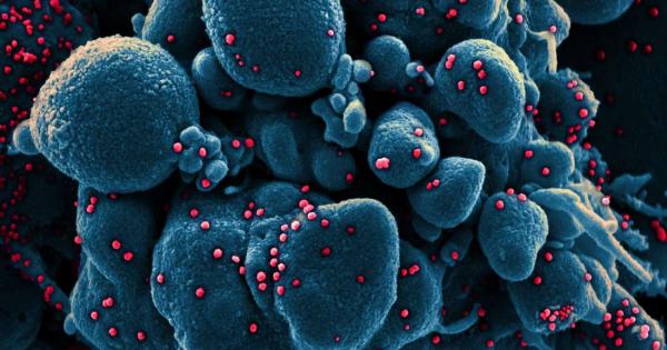 Повечето случаи на новия коронавирус са леки но около 20