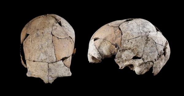 Древен череп с дупки в слепоочните кости, изглежда, е най-ранното