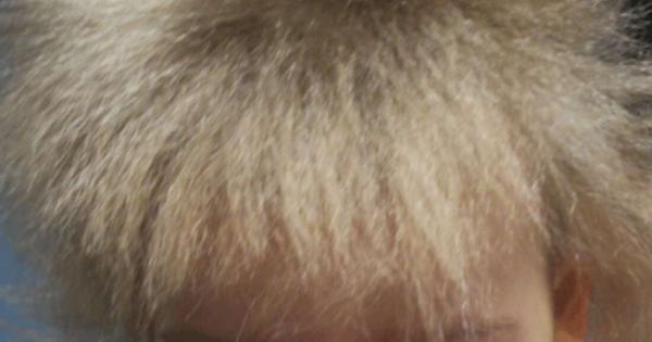 Чували ли сте за синдрома на непокорната коса Не Кейтлин