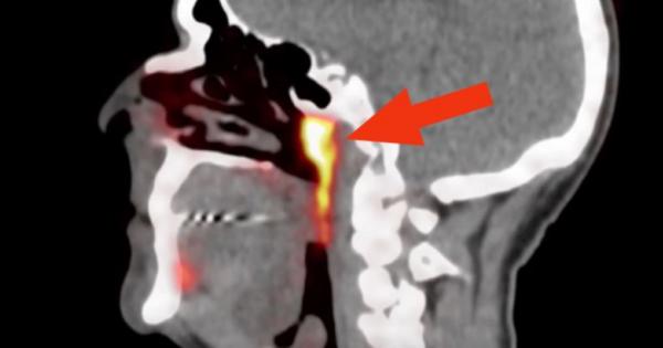 Медицински изследователи направиха изненадващо анатомично откритие – те се натъкнаха