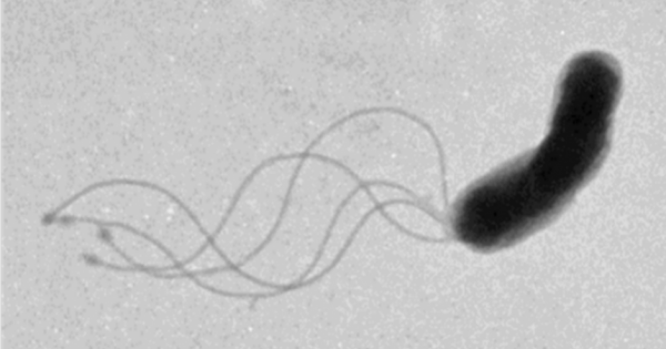 Изследователи надникнаха през високотехнологичен микроскоп към внезапно замразени протеини и