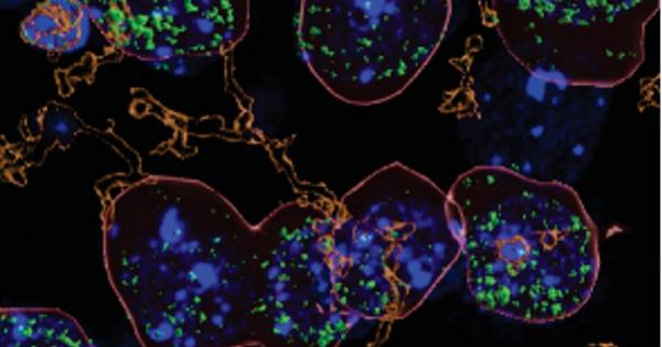 При хората страдащи от разстройство свързано с употребата на алкохол