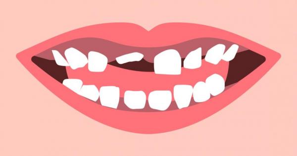 Зъбчето се клати и пада само Обикновено се случва точно