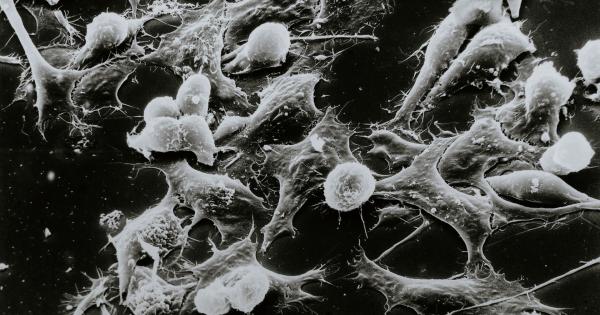 Имунологично изследване ръководено от Медицинското училище в Харвард разглежда по внимателно