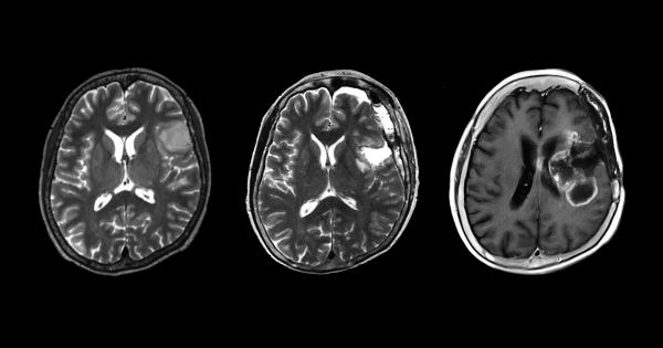 Екип от изследователи от Факултета по медицина към Университета в