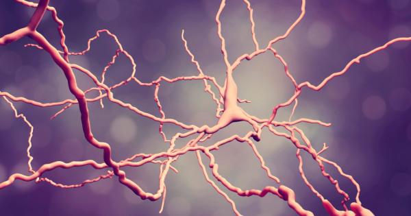 Учени откриха кои точно мозъчни клетки умират при пациенти, страдащи