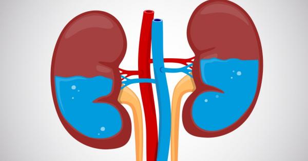 Всекидневното приемане на достатъчно количество вода е изключително важна предпоставка