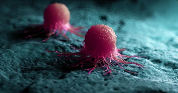 Един от най новите научни методи за лечение на рака се