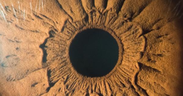 Европейски индийски и ирански лекари за първи път успешно трансплантираха