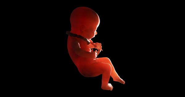 Ново изследване описва необичайния случай на нероден близнак, открит в