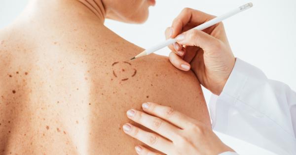 Доц д р Кристиане Талингер е световно известен експерт по дерматология