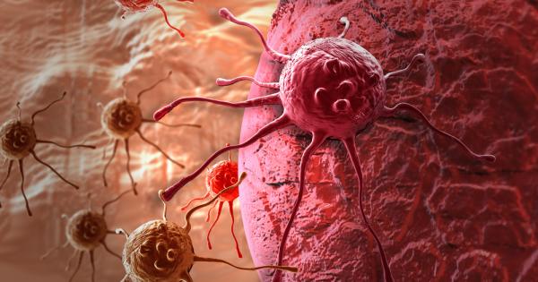 Експерти предупреждават че Европа е изправена пред епидемия от рак