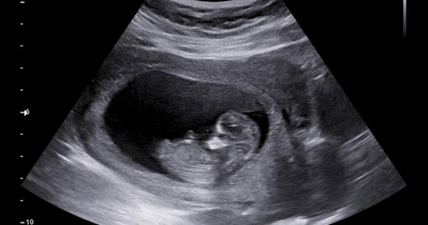 Едно от най смъртоносните състояния на бременността вече може да бъде открито
