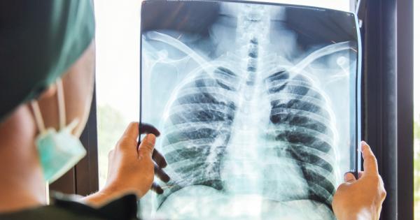 Валтер Клепетко е роден на 26 февруари 1955 г във