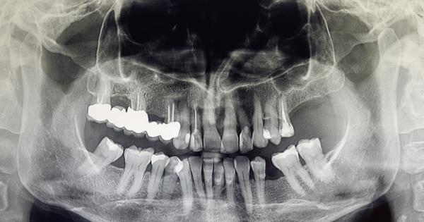 През XX век консумирането на радиоактивни материали било същински хит На 1 ви