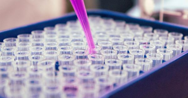 COVID 19 продължава да заразява и отнема живота на множество хора