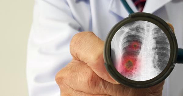 Световната здравна организация СЗО обяви официално новия коронавирус за пандемия