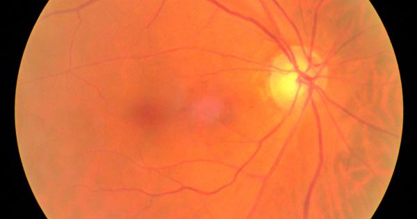 Учени откриха нов начин посредством който да регенерират увредени оптични