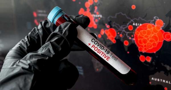 Пандемията от коронавирус вероятно ще затихне до две години Това