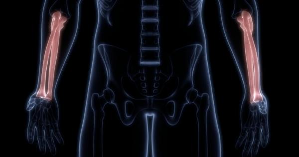 Въпреки че мъжете и жените могат да страдат от едни