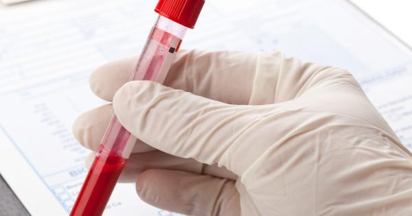 Тестът се основава на ДНК която се отделя от съответните