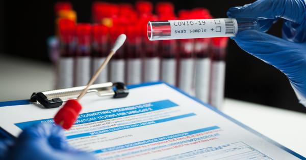 Румънски учени са създали PCR тест който установява не само