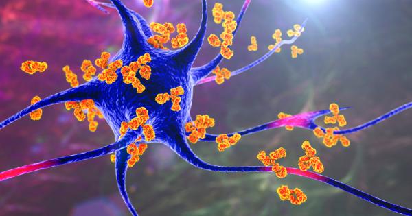 Имунната система е наш основен защитник Понякога обаче тя може