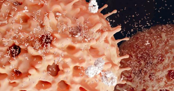 Нашата имунна система определено не е съвършен механизъм При милиони хора