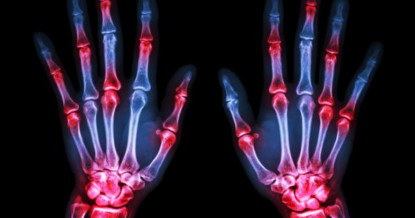 Терапия с моноклонални антитела показва ефикасност при въздействие върху имунната