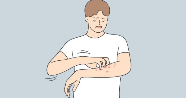 Хроничният често е сърбеж едно от най неприятните и влудяващи усещания