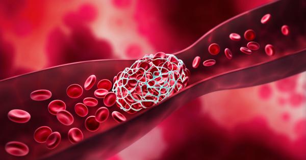 Широкоразпространеният антикоагулант варфарин има противоракови свойства установи проучване на изследователи