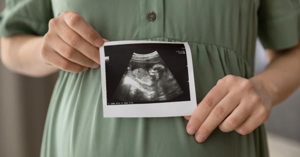 След като преживява болката от три скорошни спонтанни аборта Кара