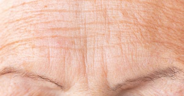 Да остаряваме грациозно означава да приемем бръчките които животът е