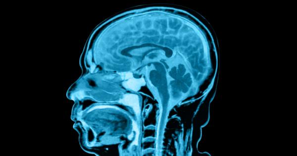 Според ново изследване размерът на човешкия мозък вероятно се увеличава